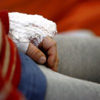 Четыре часа в очереди со сломанным пальцем. Почему охрана Детской больницы выставила отца с ребенком за дверь