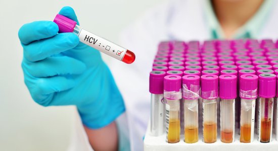 В Центре инфектологии из-за высокого спроса уже нельзя сдать бесплатный тест на гепатит С