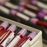 У шести доноров крови нашли сифилис