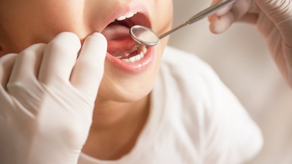 Ne tikai caurumi zobos: ko zobārstniecība atklāj par mikrobiomu, pēta RSU