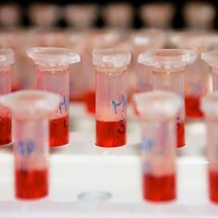 No HIV 'izārstētajam' ASV bērnam atkal atklāj nāvējošo vīrusu