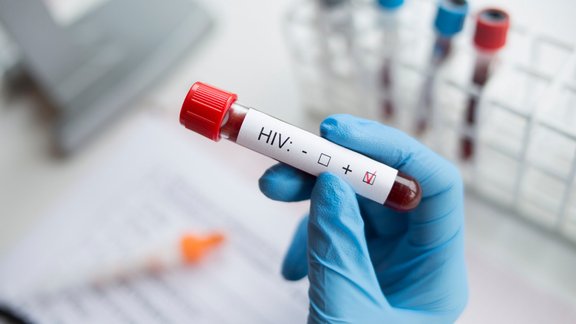 HIV tests