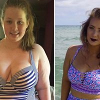'Instagram' bez iemesla dzēš 50 kilogramus zaudējušas jaunietes pārmaiņu foto