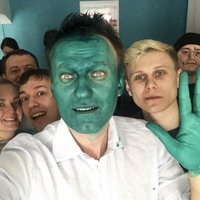 Навальный получил химический ожог глаза после нападения с зеленкой