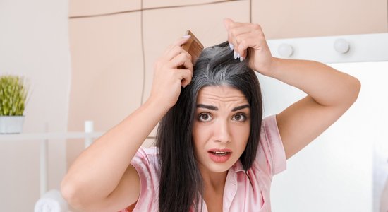 Vai stress var padarīt matus sirmus? Zinātne saka – jā