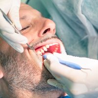 11 biežāk uzdotie jautājumi par zobu sakņu kanālu ārstēšanu. Atbild speciālists