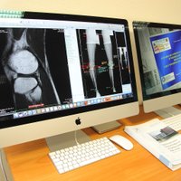 Traumatoloģijas slimnīcā atklātā ortopēdijas laboratorija izmaksājusi 36 tūkstošus eiro