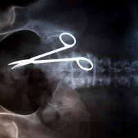 40 unikāli foto ar ļoti dīvainiem rentgenuzņēmumiem