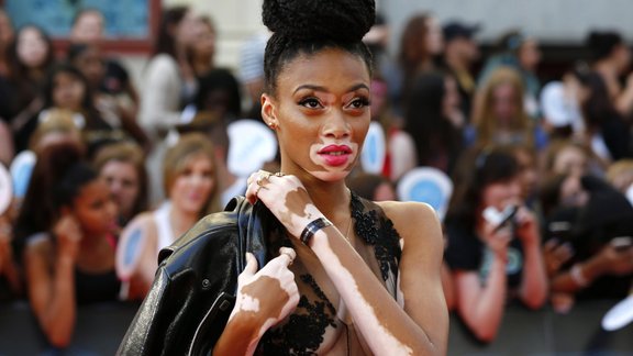 winnie harlow