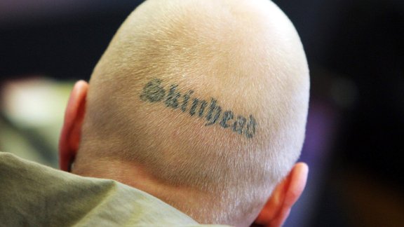 skinhead