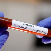 В Японии зафиксирован первый случай смерти от коронавируса