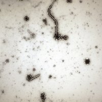Kongo DR uzliesmo Ebolas vīruss; miruši 17 cilvēki