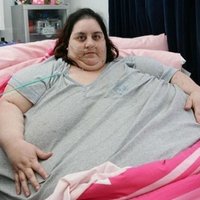 Самая толстая британка умерла, тайно объедаясь фастфудом в клинике
