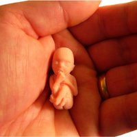 Сейм не поддержал более строгие ограничения в отношении абортов