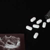 Право на таблетку. Как коронавирус меняет доступ женщин к абортам?