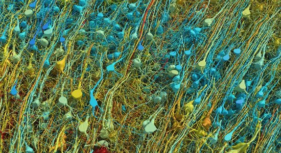 Kubikmilimetrā cilvēka smadzeņu atklāj fantastiski sarežģītu pasauli