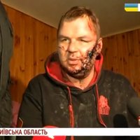 Video: 'Paldies Dievam, esmu dzīvs,' teic spīdzinātais Ukrainas aktīvists