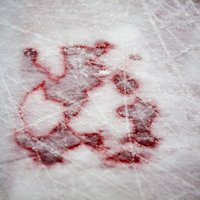 Ādama Džonsona traģēdija hokeja laukumā. Cik bīstams ir hokejs?