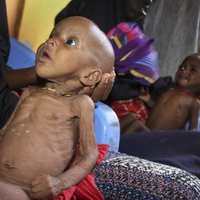Lielākā humānā krīze kopš 2. Pasaules kara: bada nāve draud 20 miljoniem cilvēku