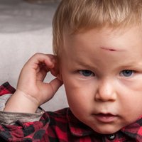 Эксперты бьют тревогу: в большинстве случаев тяжелых детских травм виноваты родители