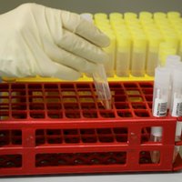 Koronavīruss Latvijā reģistrēts vēl diviem cilvēkiem; viens Covid-19 saslimušais stacionēts