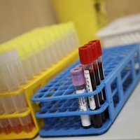 В Латвии четыре новых случая заражения новым коронавирусом