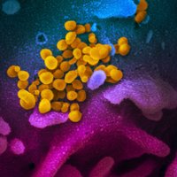 Pētījums: koronavīrusa britu paveids par 64% nāvējošāks nekā sākotnējie paveidi