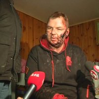 Piekautais Ukrainas aktīvists caur Latviju dodas ārstēties uz Viļņu