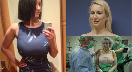 Operāciju šova Danēlai krūtis nu ir par sešiem izmēriem mazākas
