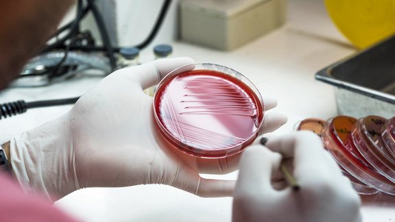 Laboratorija baktērijas antibiotiku rezistence