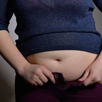 Latvijā liekais svars skar 34% cilvēku, bet aptaukojušies ir 30%