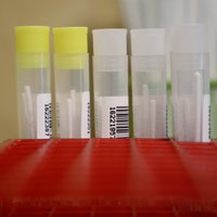 За сутки в Литве подтверждено 8 новых случаев коронавируса