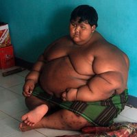 "Самый толстый в мире ребенок" за месяц сбросил 31 кг