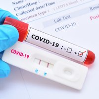 За сутки в Латвии выявлено 995 новых случаев Covid-19