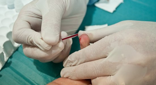 Bezmaksas B un C hepatīta testu pagājušajā nedēļā veikuši teju 900 cilvēki; 47 izrādījušies pozitīvi