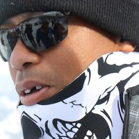 Fotogrāfs Taigeram Vudsam kalnu slēpošanas sacensībās izsit zobu